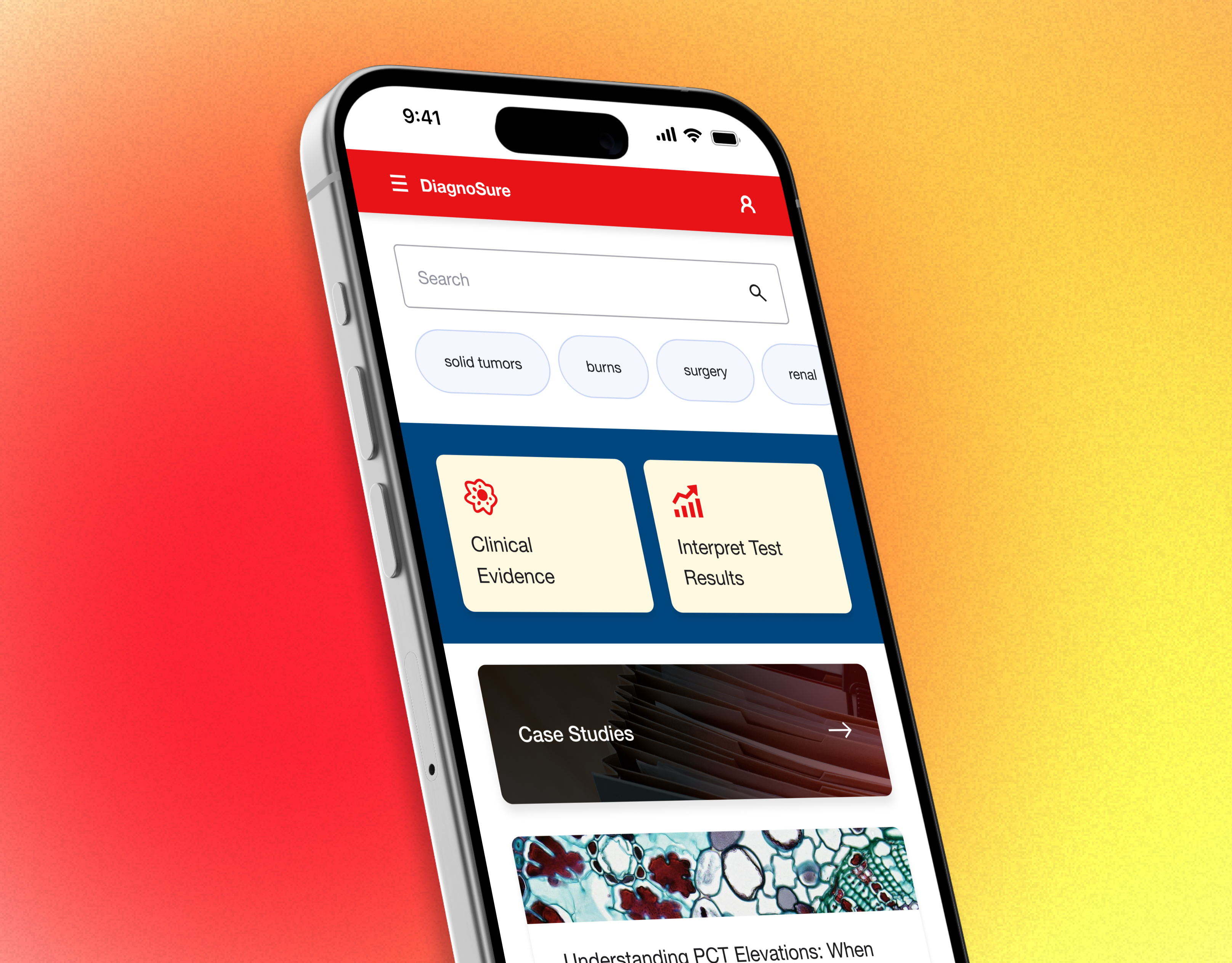 A mockup of an iphone screen.